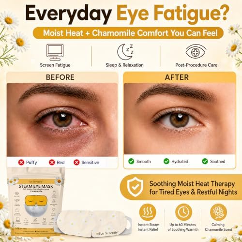 Eye Serenity Steam Eye Mask, Heated Eye Mask Fast Relief for Stye Chamomile - Image 2