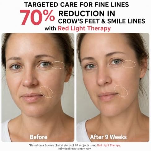 Red Light Therapy for Face, FDA-Cleared Blue Light Mask for Acne - Image 4