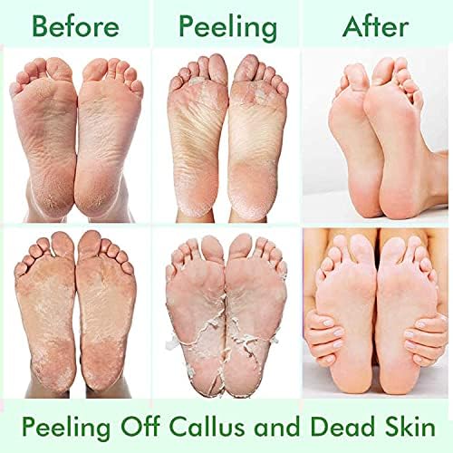 5 Pack Foot Peeling Mask,Exfoliator Peel Off Calluses Dead Skin Callus Remover,Foot Mask for Dry Cracked Feet,Foot Peel Masks for Men and Women,Feet Peeling Mask,Spa Gifts for Women,Self Care Gifts - Image 3