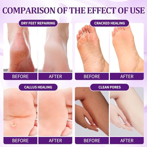 24 PCS Foot Soak, Pedicure Kit Foot Soak Set With Bubble Salt, Sugar Scrub, Massage Mask, Massage Lotion In a Box 4 Step Foot Spa Kit For Dry Cracked Feet, Tired Feet, 6 Set Lavender - Image 3