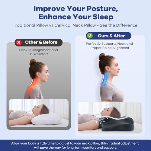 DONAMA Cervical Pillow for Neck Pain, Ergonomic Memory Foam Contour Pillow - Image 6