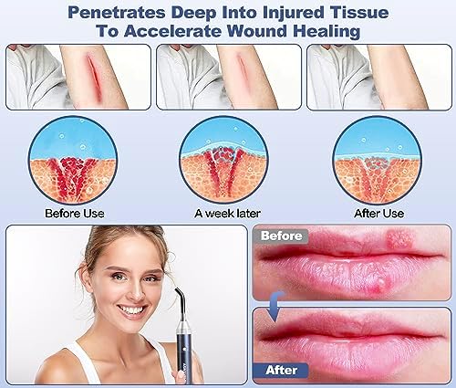 Infrared Red Light Device for Joints & Muscles, 460:630:660:850:900nm Cold Sore, Portable Near Infrared Wand for Face & Body Mouth Nose Effective 2 in 1 Modes - Image 2